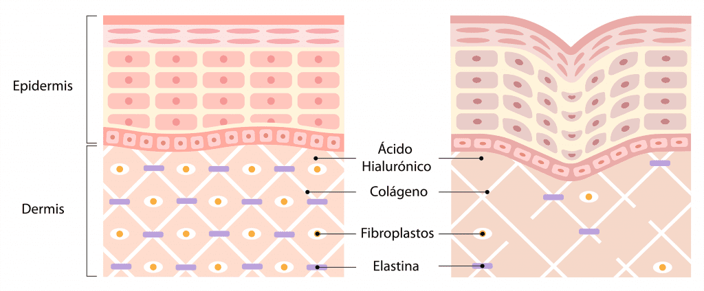 Epidermis Dermis piel