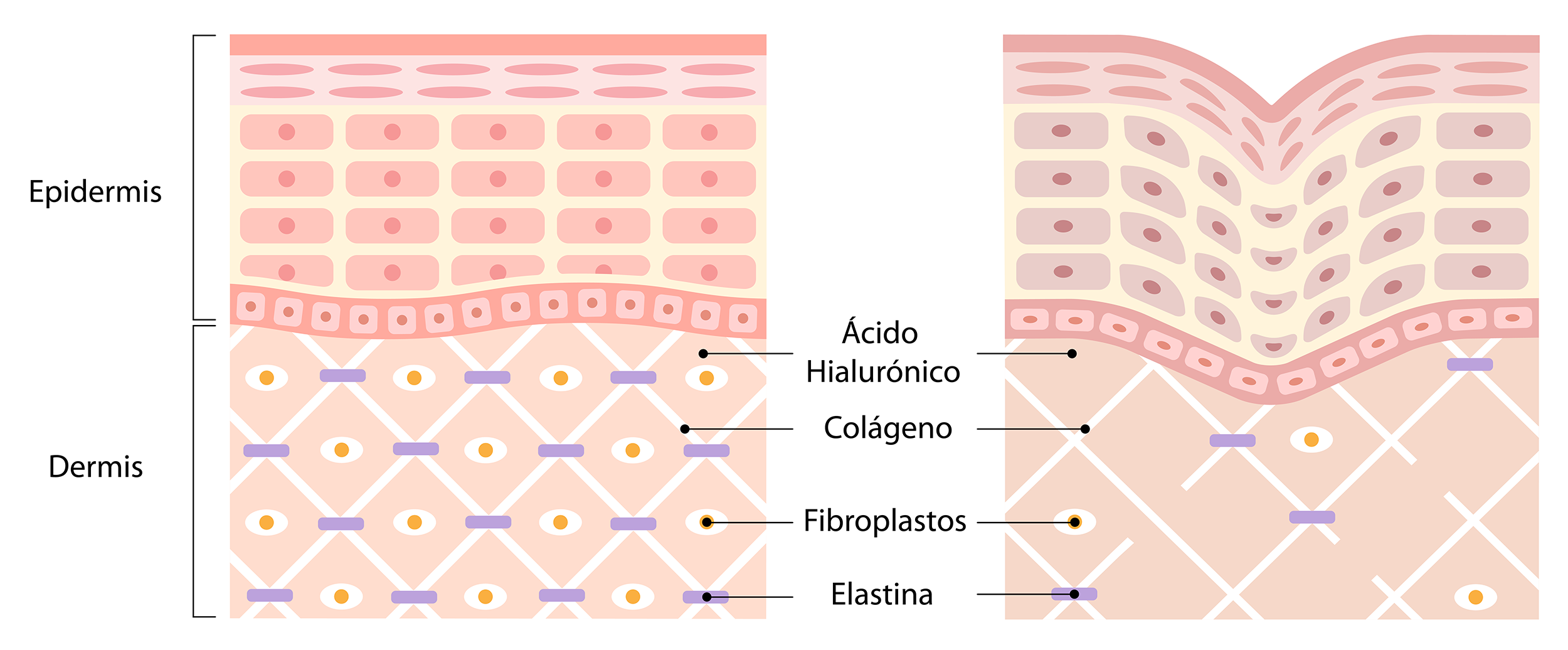Epidermis Dermis piel